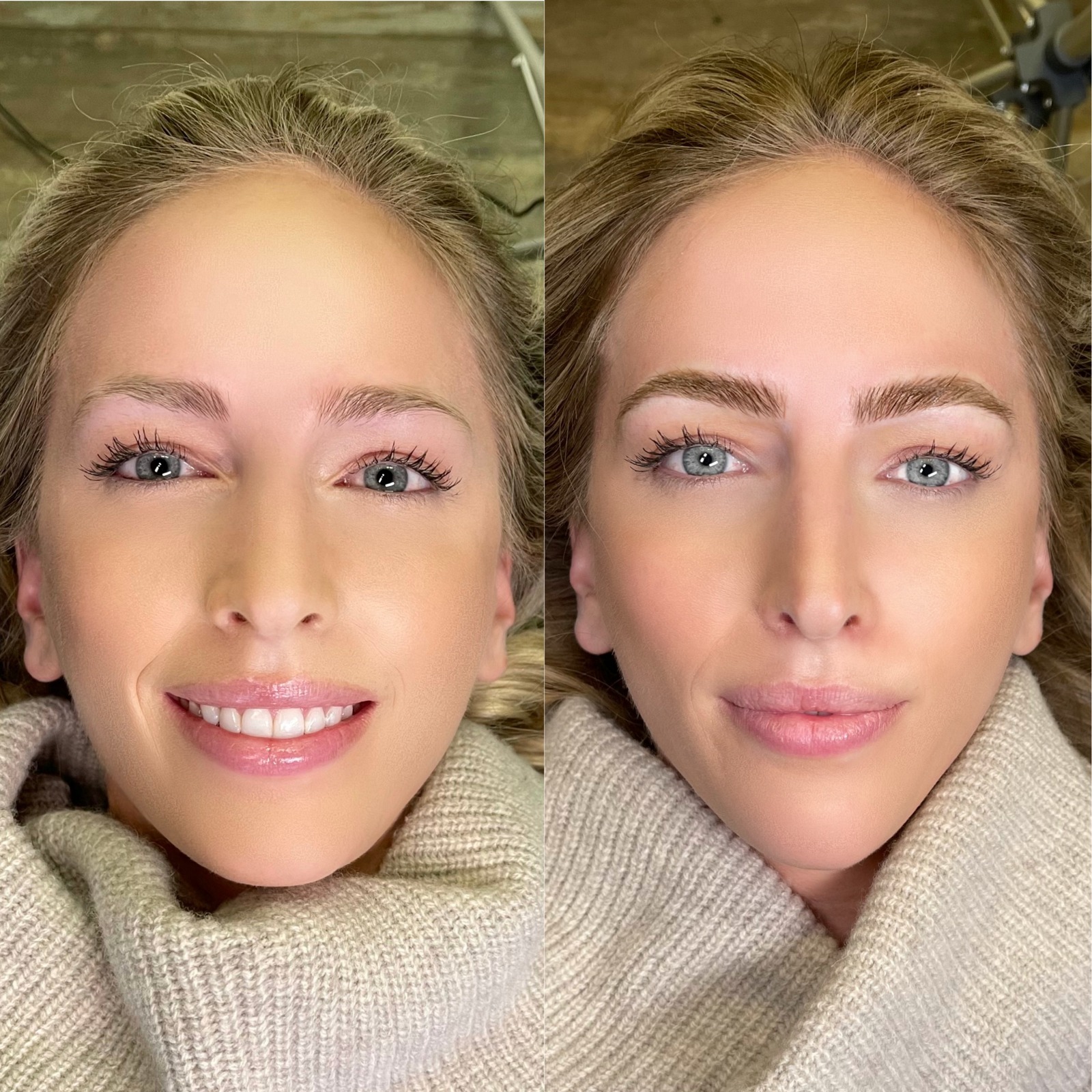 Maui Browi natural client transformation in San Clemente